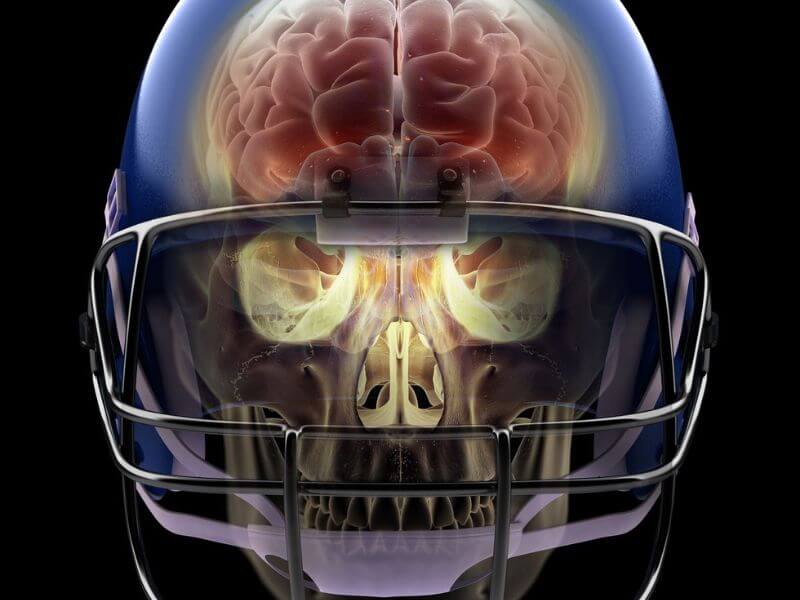 what is cte in football